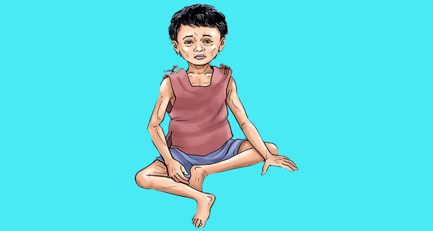 कुपोषित बालबालिकालाई स्वस्थ बनाउँदै रुम्जाटार अस्पताल